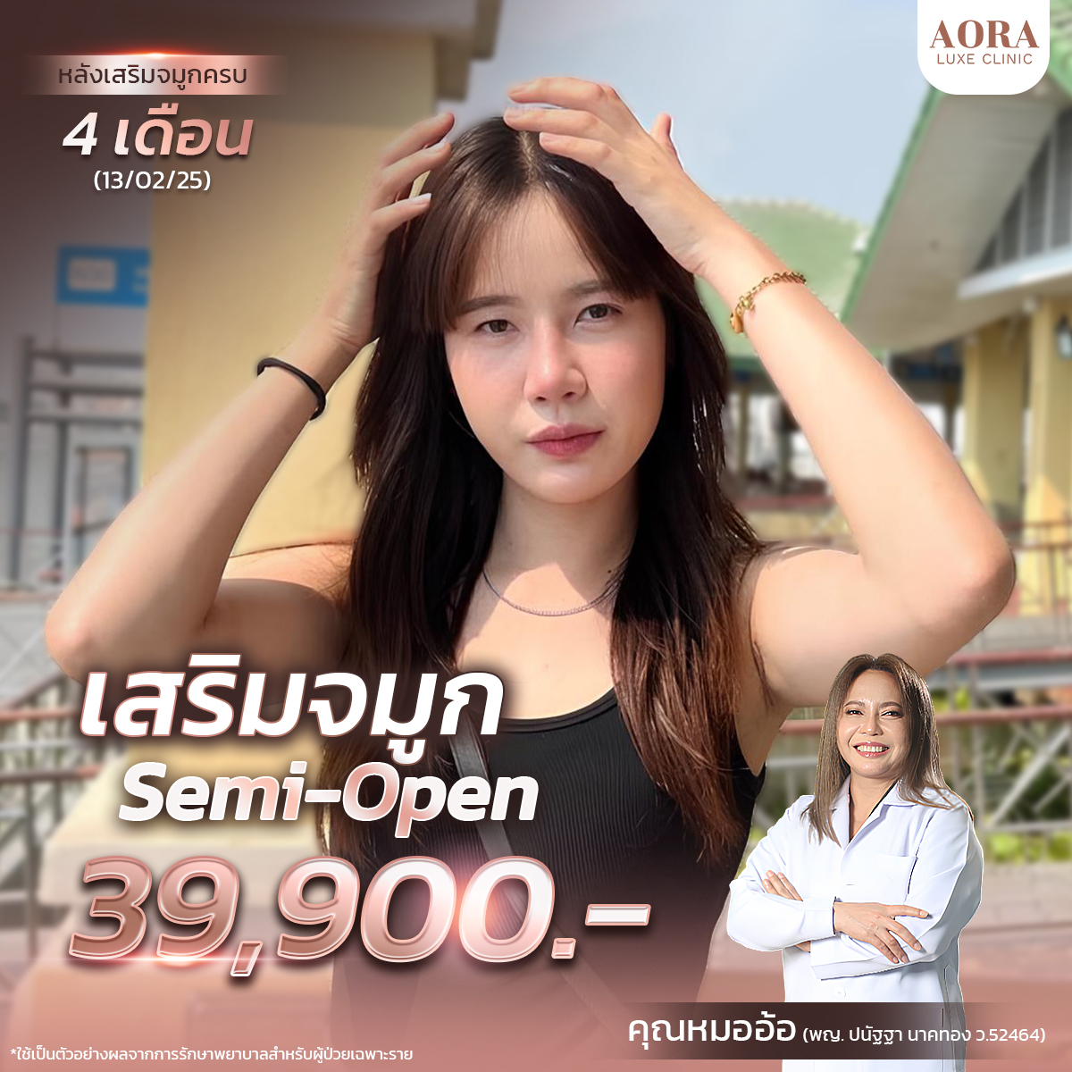 Aora Banner_3