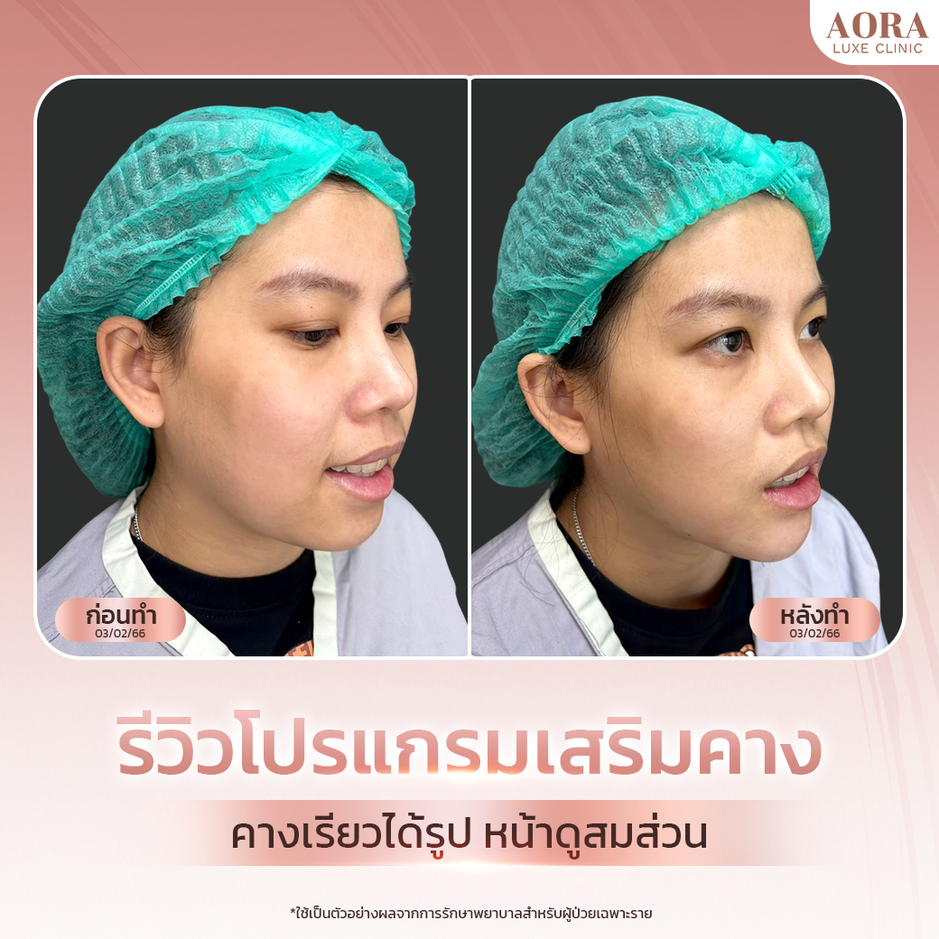 Aora Banner_73