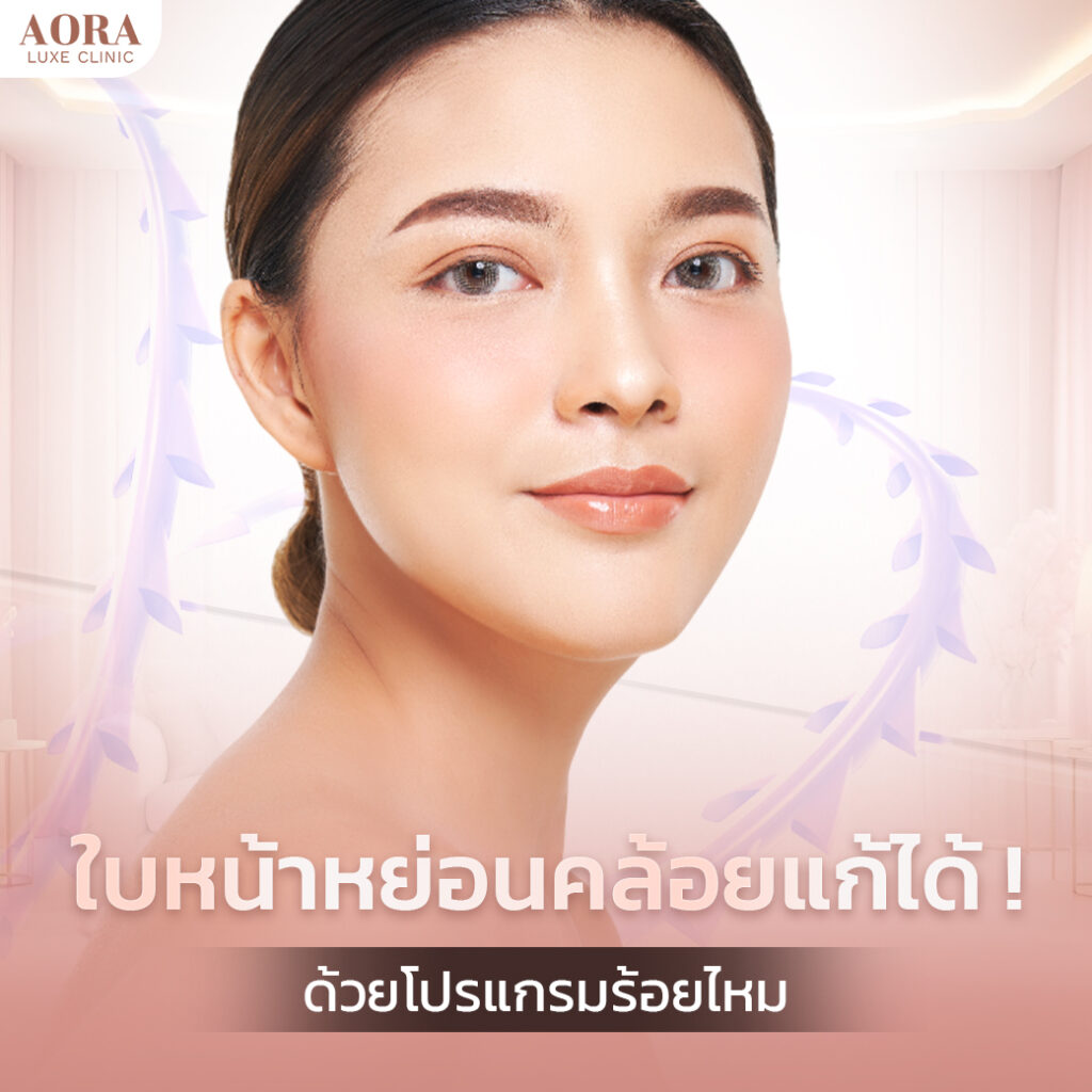 ร้อยไหม (Thread Lift) ยกกระชับ ปรับรูปหน้าอย่างมั่นใจ